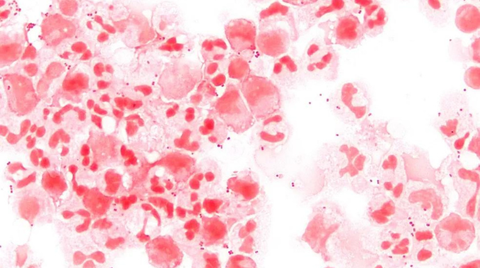 Neisseria meningitidis, a bactéria que causa a meningite meningocócica — Foto: Wikimedia/Divulgação